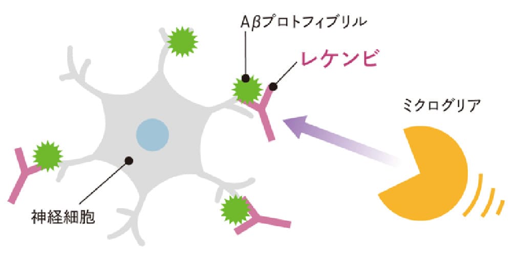 レカネマブ（レケンビ）のイメージ図1