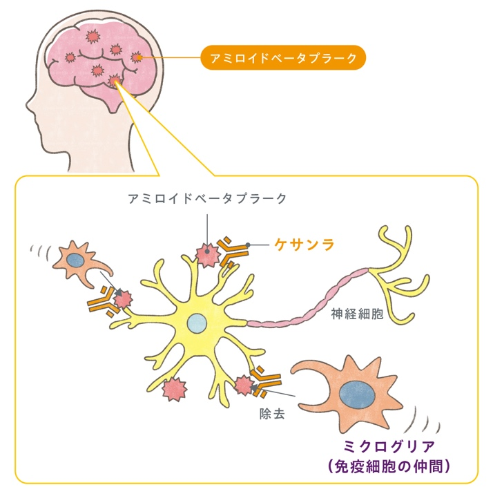 ドマネマブ（ケサンラ）